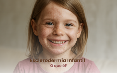 Esclerodermia Infantil: O que os pais precisam saber?