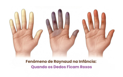 Fenômeno de Raynaud na Infância: Quando os Dedos Ficam Roxos
