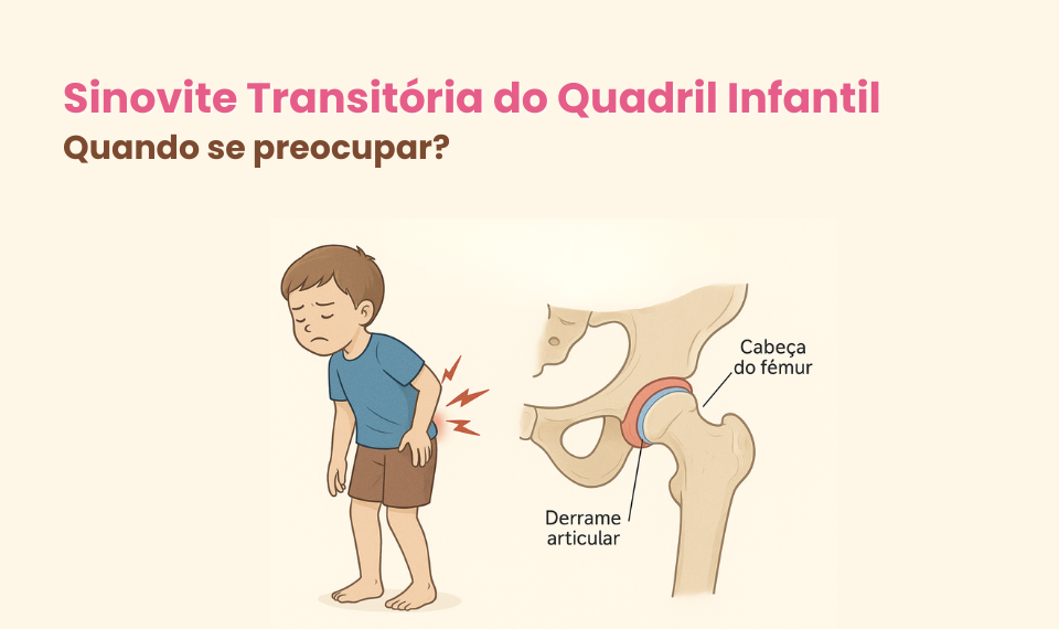 Sinovite Transitória do Quadril Infantil: Quando se preocupar?